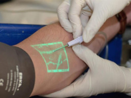 Near-Infrared Light Assists Phlebotomists In Finding Veins
